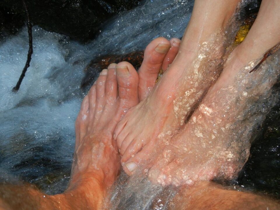 Mycosis of the nails of the legs